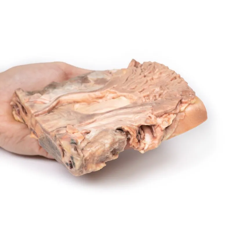 3D Printed Chronic Gastric Ulcer