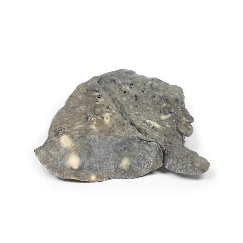 3D Printed Lung - Multiple Secondary Carcinoma Depisits in the Lung and Pleura